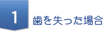 歯を失った場合